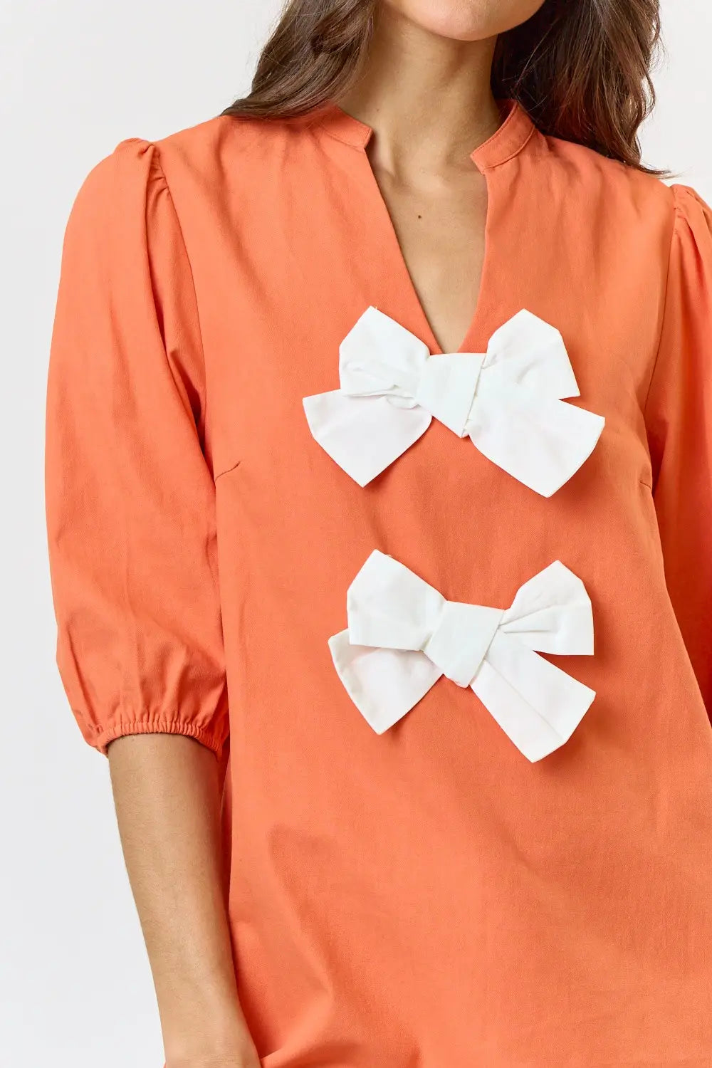 Detailed Bow Dress